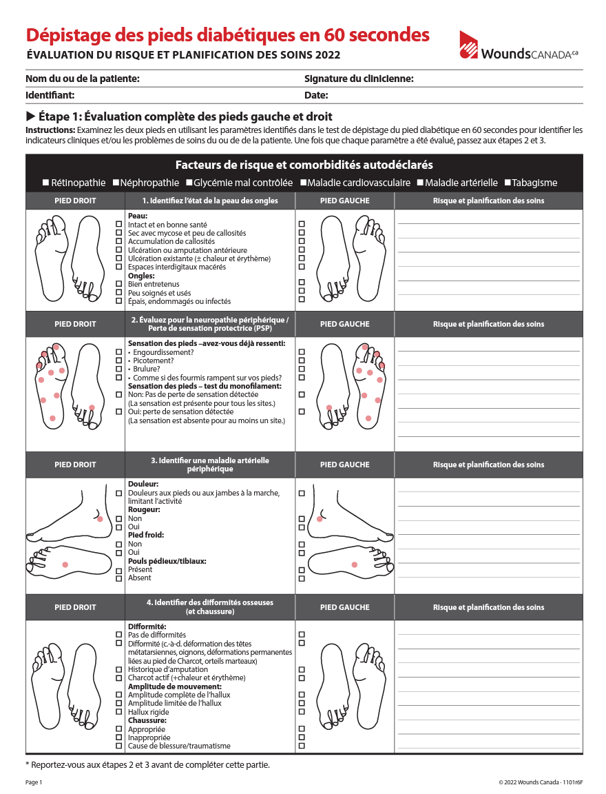 Dépistage des pieds diabétiques en 60 secondes